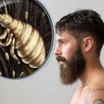 Preocupación por piojo que ataca barbas de lumbersexuales