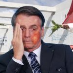 Quemaduras en rostro de Bolsonaro tras caerle agua bendita